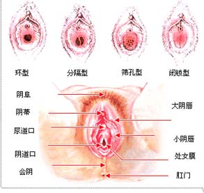 处女膜生理图处女膜照片